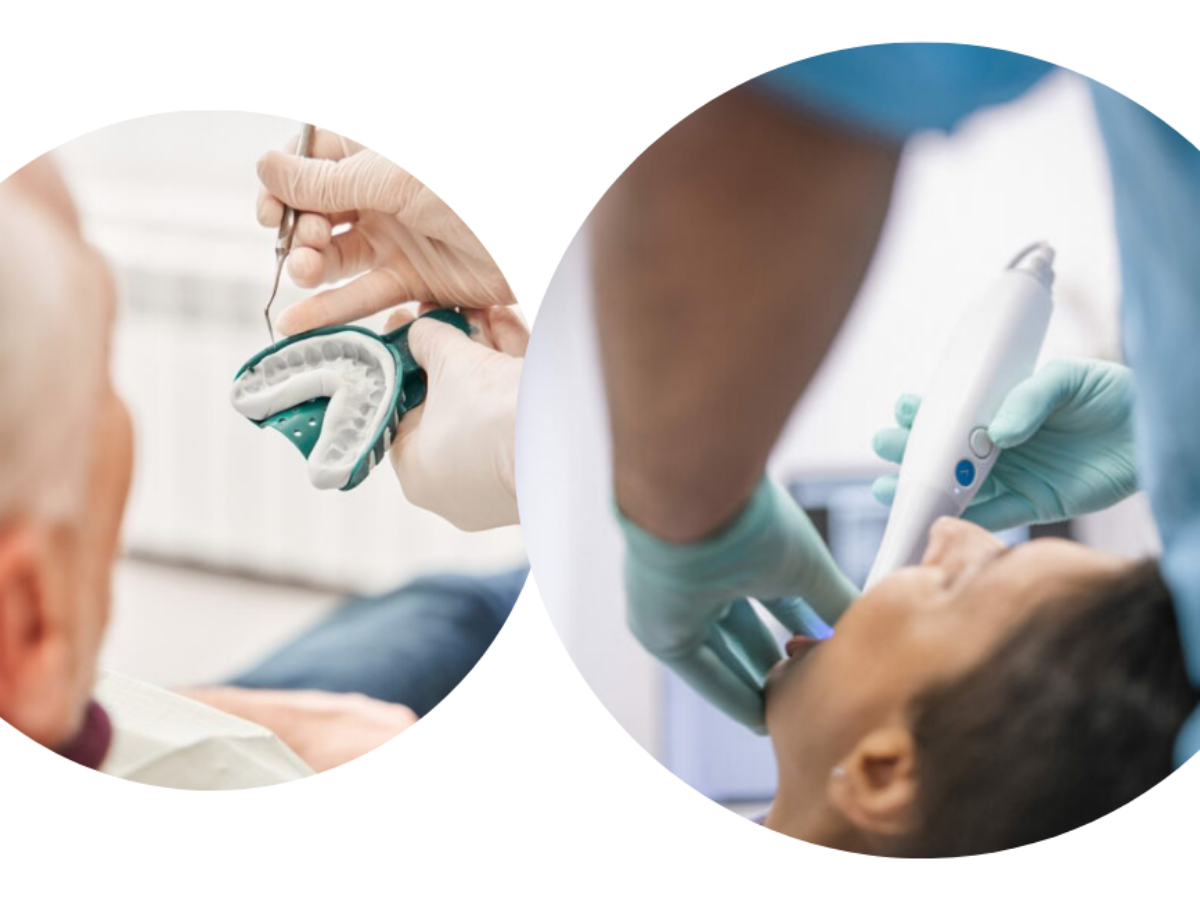 The Blueprint For A Perfect Impression: A Dentist's Guide to Accuracy