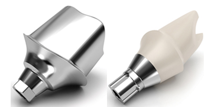 Precision Planning: A Doctor’s Guide to Successful Custom Implant Abutments