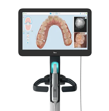 iTero intraoral scanner.