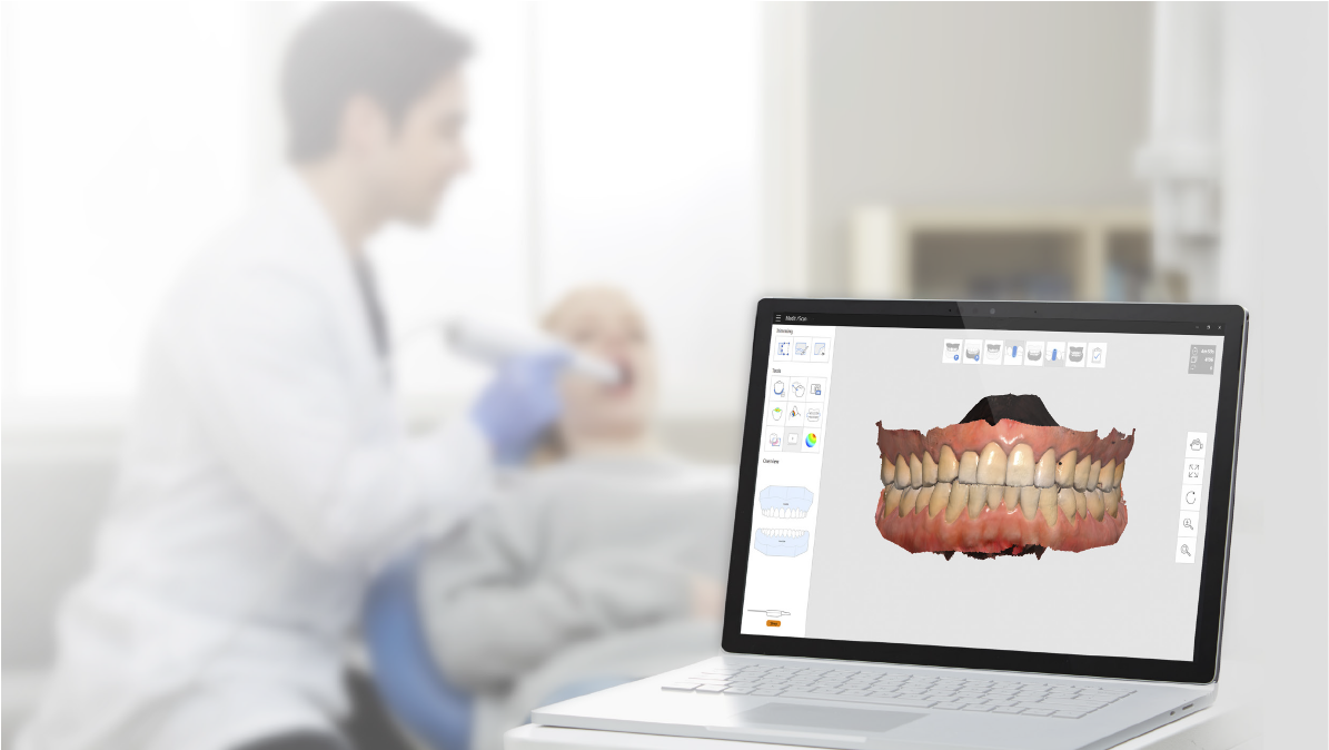 The Blueprint For A Perfect Impression: A Dentist's Guide to Accuracy