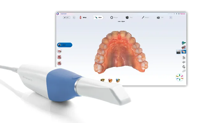Image description