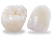 IPS e.max crowns